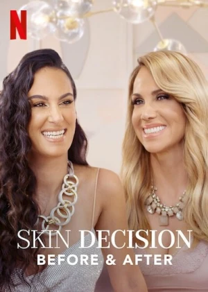  Skin Decision: Before and After - Saison 1 affiche 